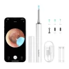 Отоскоп з камерою BEBIRD T15 White (6972403822470)