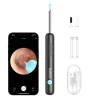 Отоскоп BEBIRD R1 з камерою Black (6972403827796)